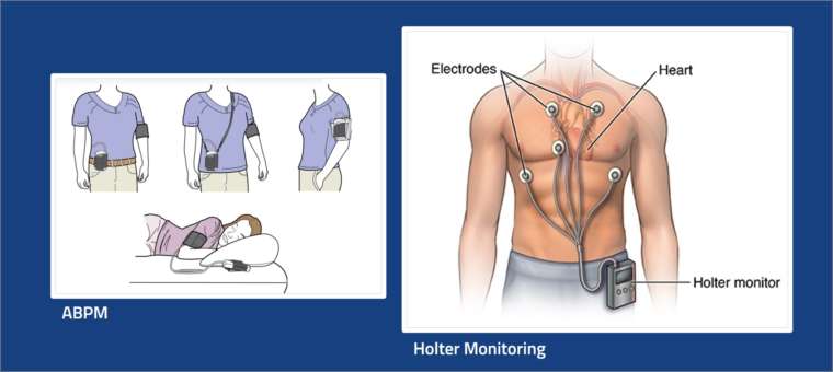 Ambulatory Blood Pressure Monitoring (abpm) And Holter Monitoring 