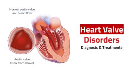 heart_valve_conditions_main